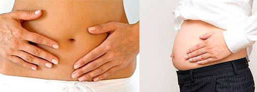 ColonIrritable Colon Irritable