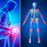 TratamientoDolorArticular-e1687656991329-150x150 Osteoartrosis o Artrosis