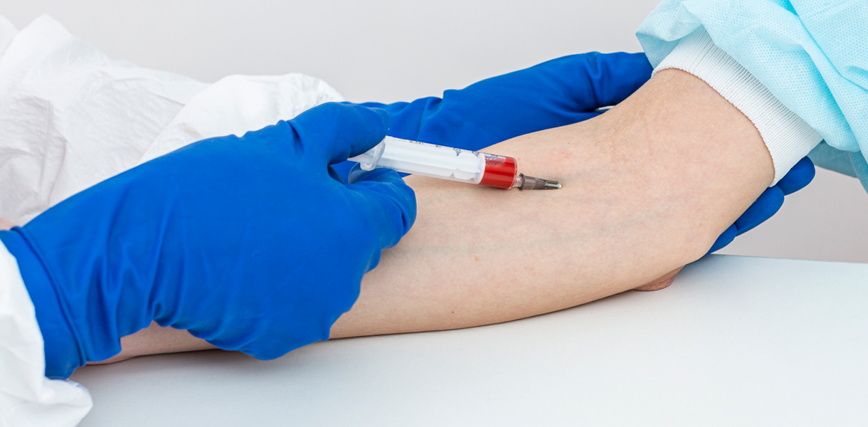 Autohemoterapia- Autohemoterapia